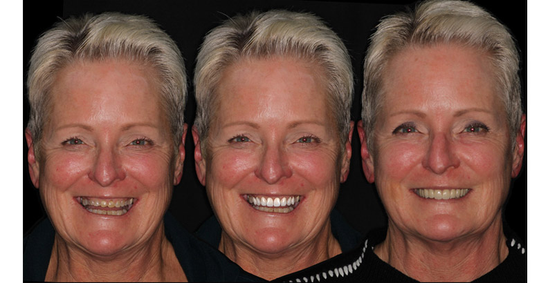 Cosmetic Dentistry in Wappingers Falls