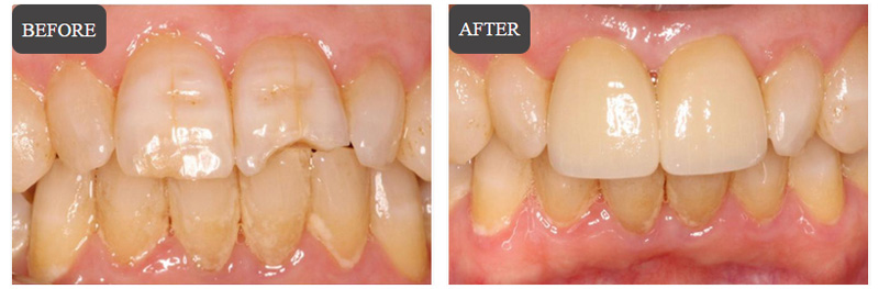 Cosmetic Dentistry in Wappingers Falls