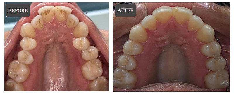 Cosmetic Dentistry in Wappingers Falls