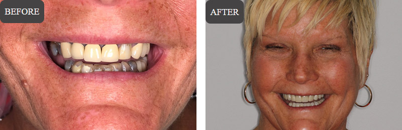 Cosmetic Dentistry in Wappingers Falls