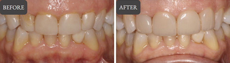 Cosmetic Dentistry in Wappingers Falls