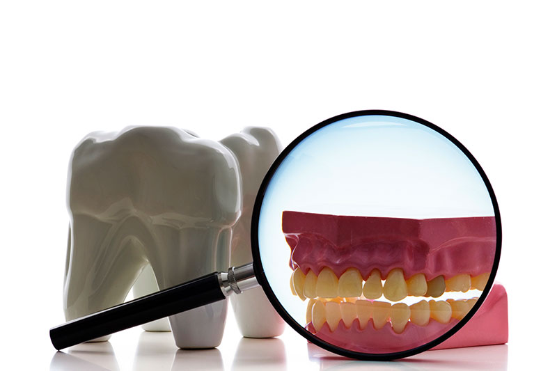 Root Canal in Hudson Valley
