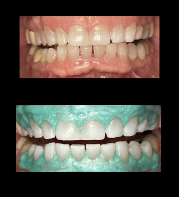 Cosmetic Dentistry in Hudson Valley